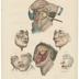 A Treatise on Operative Surgery color engravings, 1852