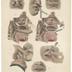 A Treatise on Operative Surgery color engravings, 1852